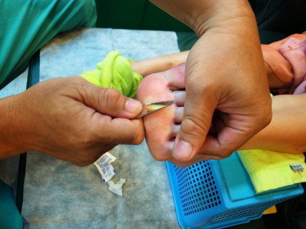 飛來發推拿養生館(士林二館):士林飛來發之上海削腳皮