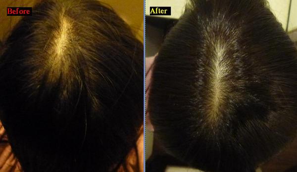 Dear-Logue Taipei：【口碑劵】Dear-Logue-Taipei，體驗日系美髮時尚小變身