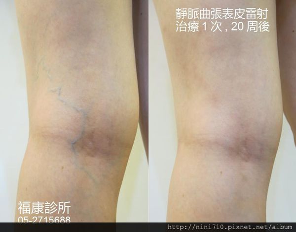 1620501_604787792929473_1257481675_n