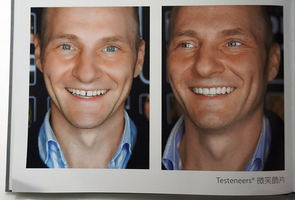 Visiro Café & Smile Beauty 複合式口腔美容咖啡概念店：[忠孝敦化] 咖啡廳 Visiro Café & Smile Beauty - 香港雞蛋仔鬆餅.手作甜點.咖啡.焗烤.帕尼尼